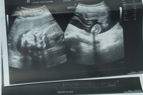 Sure na kayang boy to? 23weeks na ko at sana totoo boy na to.