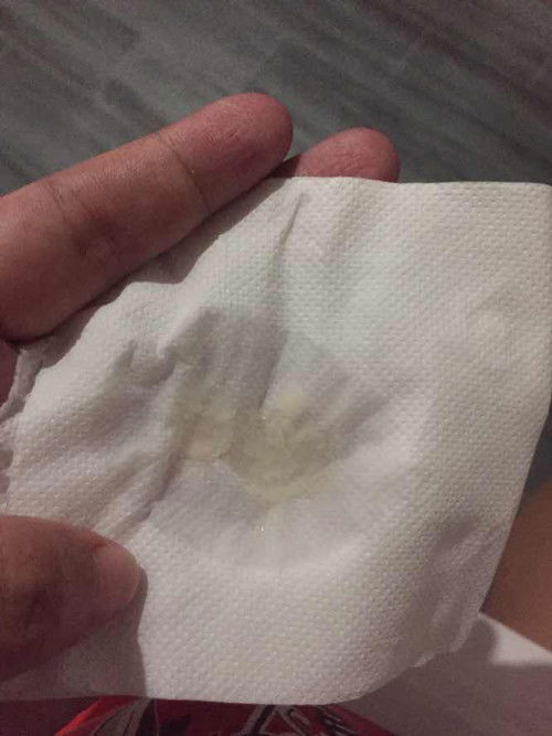 36 weeks 3 days
EDD nov 25