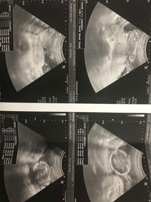 ผู้ชายหรือผู้หญิงคะ?