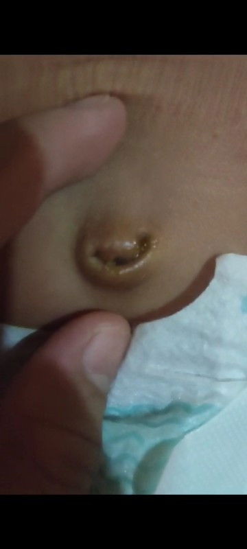 Pusar baby berarir, agak harum aromanya