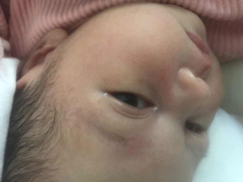 ลูกมีตุ่มแดงๆขึ้น