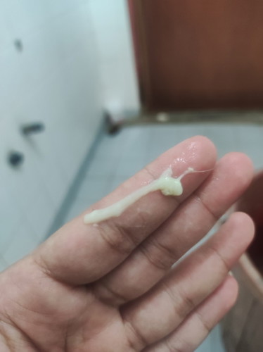 Mucus plug atau keputihan
