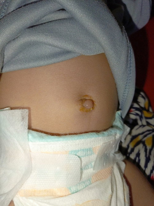 pusar bayi