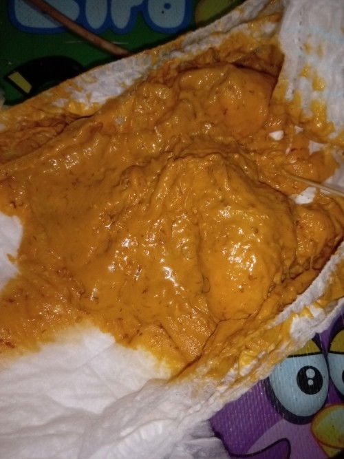 Bab bayi ada seperti cacing merah