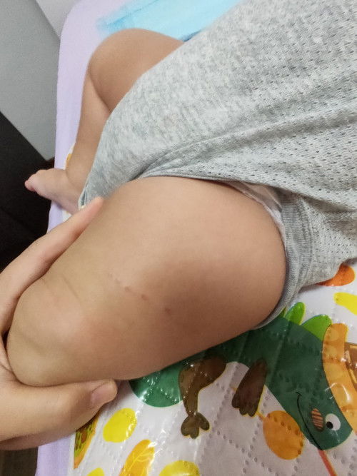 What are these bumps ?