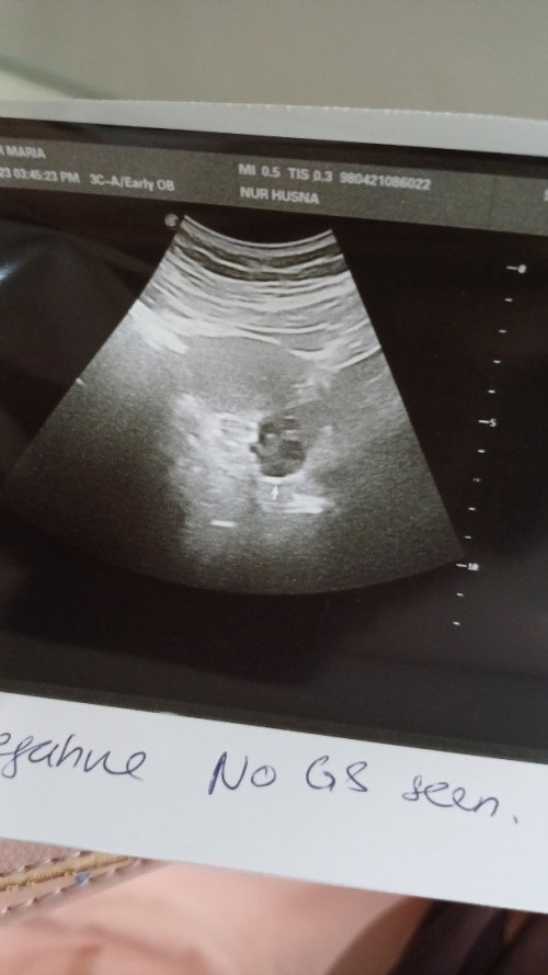 Gugur or False Pregnant?