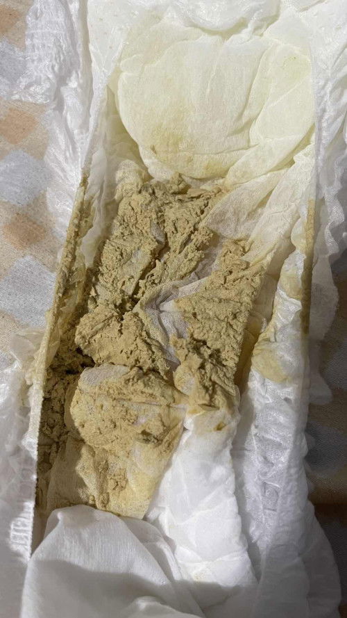 อึลูกชายสีนี้ ปกติมั้ยคะ