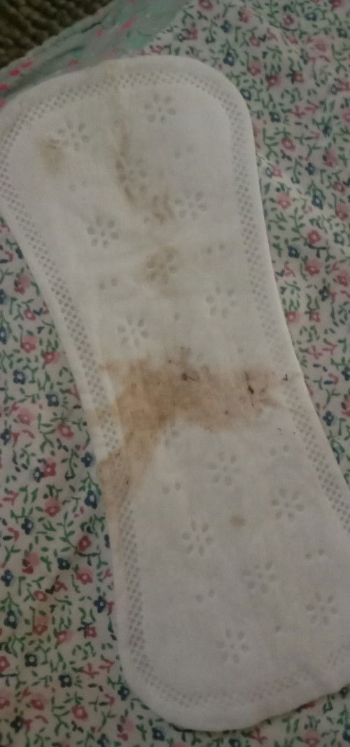 LIGHT BROWN SPOTTING 30 WEEKS