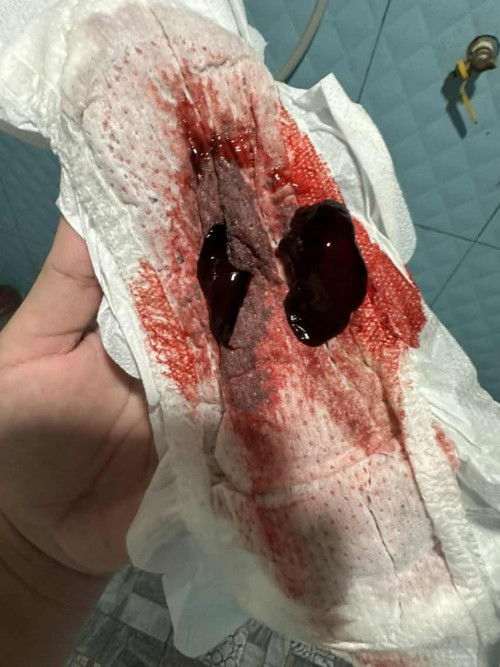 น้ำคาวปลาสีแดงสด