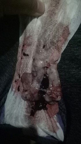Ano po kaya tong lumabas sakin?