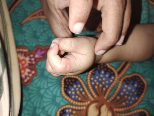 Awalnya kaya melenting ada airnya, sekarang pecah begini