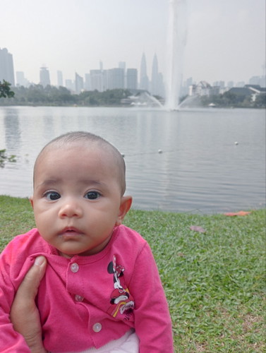 Mata baby sembab
