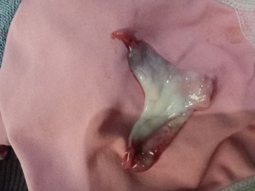 Mohon maaf jika ini jorok bund 🙏🏻🙏🏻