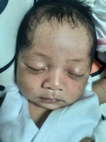 Pahelp naman po ano po tong nalabas na rashes ke LO ko po 2 weeks old pa lang...