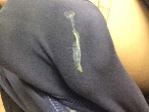 ตกขาวมันเป็นแบบนี้คะ มันเป็นเพราะอะไีรหรอคะ เพราะพึ่งเริ่มเป็นได้3-4วันแล้วคะ ขอถามผู้รู้หน่อยนะคะ