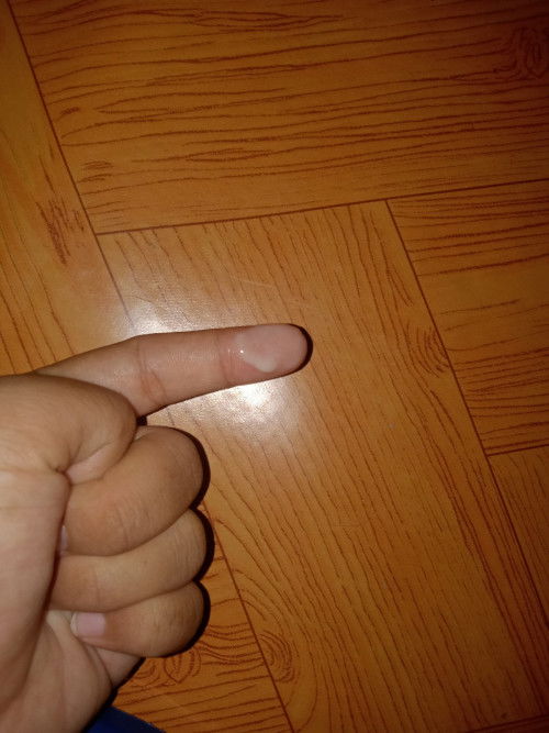 Mw tanya Bun saya hamil 8bulan sering keluar air gini ini apa ya bun