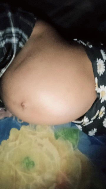 39+5 กำหนด12/11
เงียบกริบเลยค้าแม่ๆ ไม่มีอาการอะไรเลย แม่นี้อยากแตกแล้ว บวมจนเดินไม่ไหวแล้ว