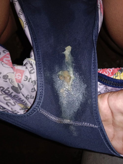 มูกใสคืออะไร