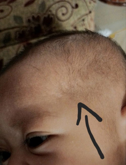 Kepala bayi bagian depan seperti agak tepos