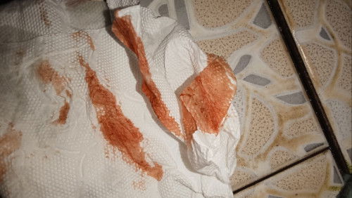 สอบถามแม่ๆหน่อยคะ