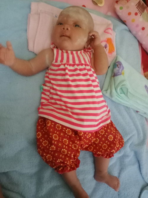 น้องตดบ่อย