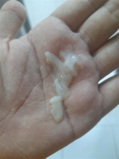 Keputihan susu bahaya atau tidak?