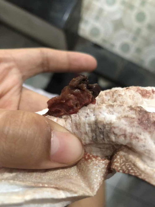 bagi pengalaman dan saran bund