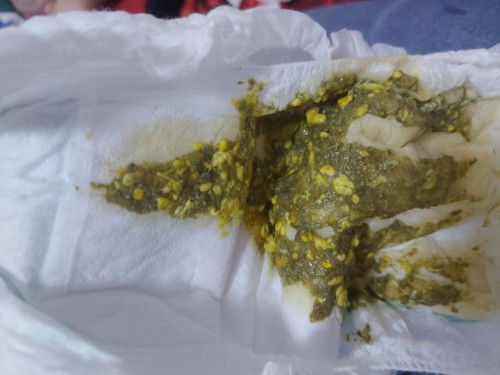 Teething or something na kailangan ika worry 🥺