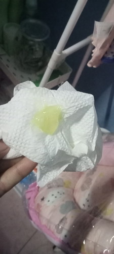 แม่เริ่มมีมูกขาวออกวันนี้แบบนี้ต้องไปโรงบาลไหมคะแต่ยังไม่ปวดท้องนะ38+1หรืออาการเตือนคะ