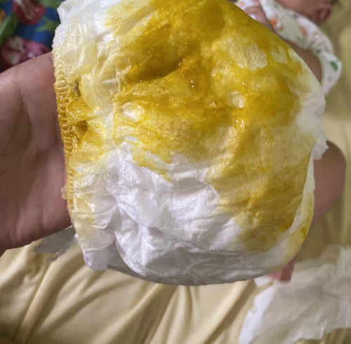 Bayi 4 bulan pup lendir