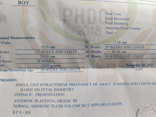 Cloudy Amniotic fluid
