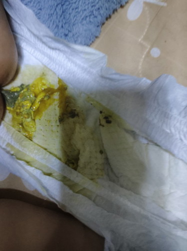 Normal po ba ang poop