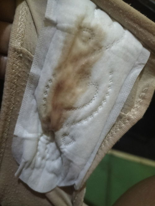 Lendir keluar di 37W