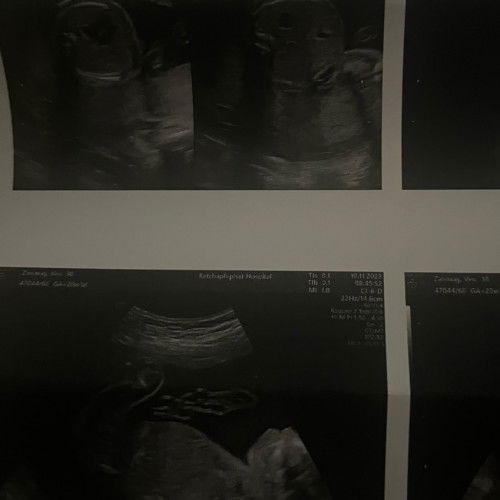 คุณแม่ท่านไหนพอจะทราบเพศไหมคะ❤️❤️