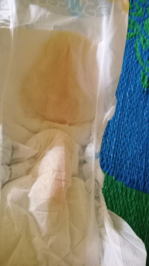 Warna urin baby oren