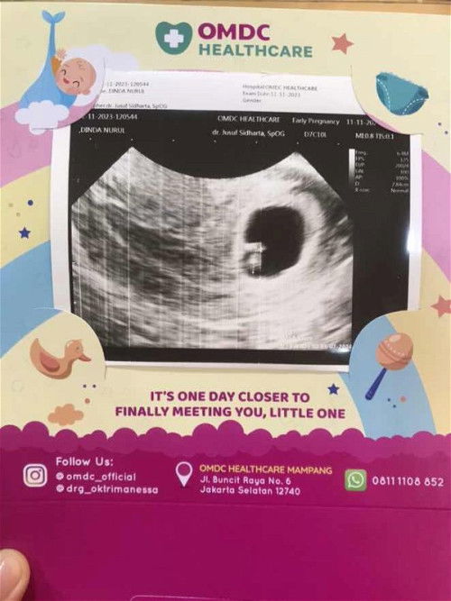 Janin harusnya sudah besar