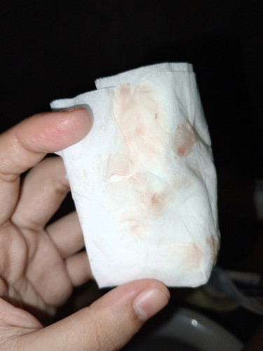 pink/brown/red discharge 11 days after my period