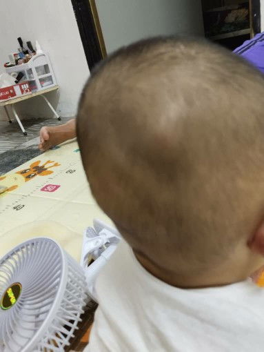 BENJOL SATU PERSATU ATAS KEPALA BABY 6 BULAN