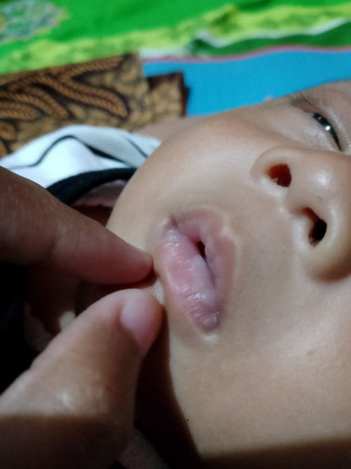 Baru banget muncul tadi siang ga ada, ini kenapa ya bibirnya begitu?