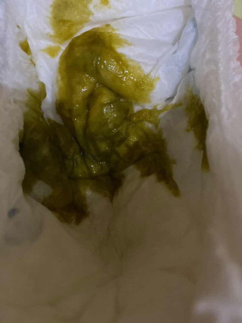 Pup bayi setelah MpAsi