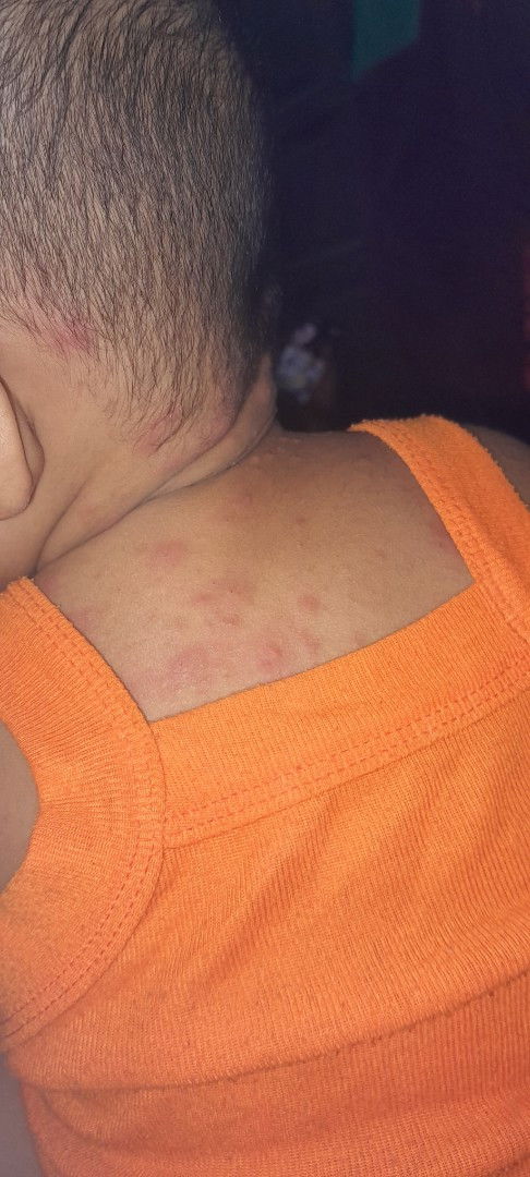 Bunda mau tanya ada gak anakny yg spt ini. Ini knp ya bund. Obat apa yg ccok bund.