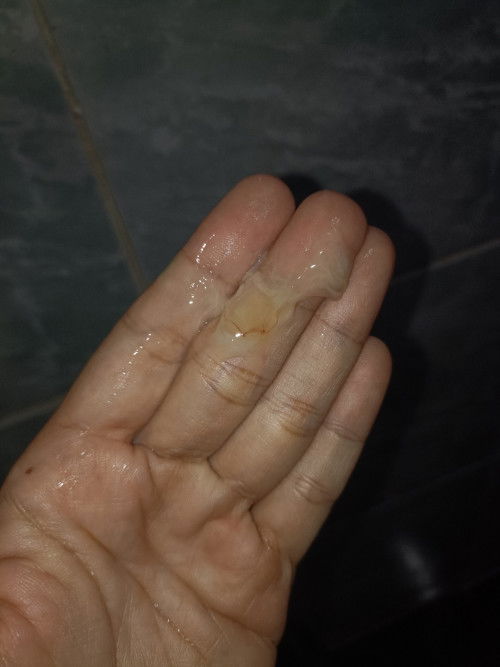 มีเลือดปนตกขาวออกมานิดหน่อย