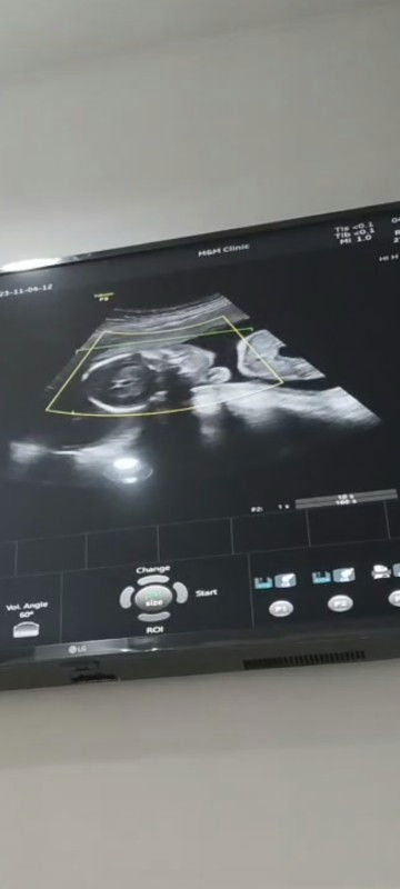 สอบถามเเม่ๆหน่อยค่ะ