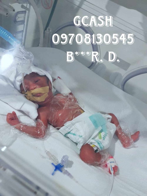 My premature baby, konting tulong lang po 🙏