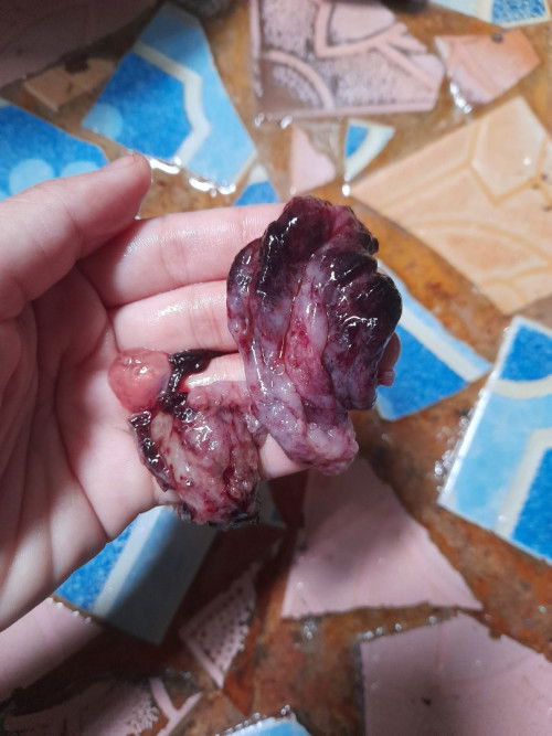 Keguguran 6 weeks dan bidakah hamil normal, tipsnya bunda?