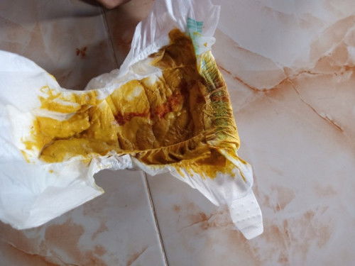 น้องถ่ายมีเลือด