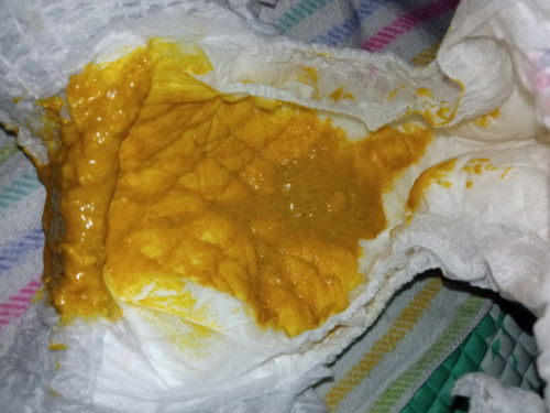 Ciri diare pada bayi