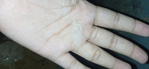 Ano po kaya to 12 weeks preggy po ako