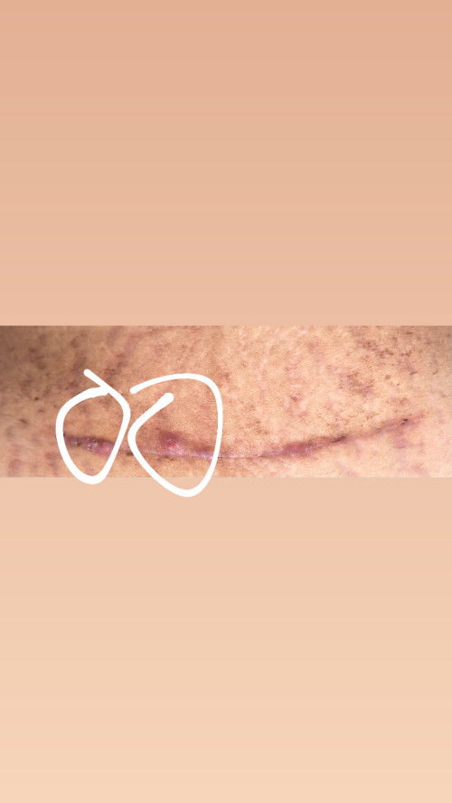 Jaitan Sc ngilu dan nyeri