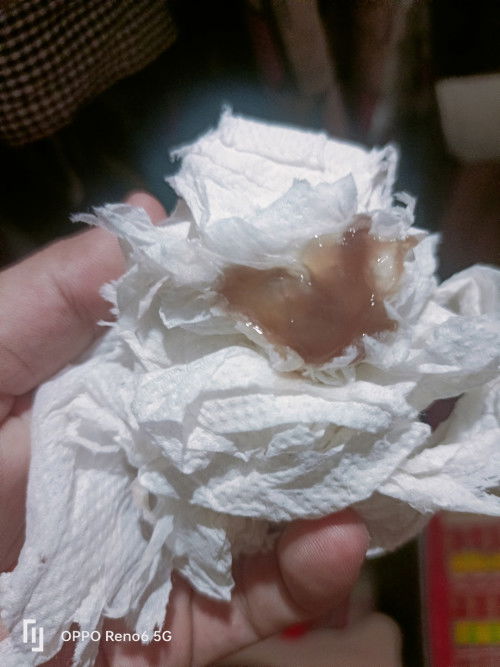 Này là gì vậy các mom e mang thai lần đầu không có kinh nghiệm ạ